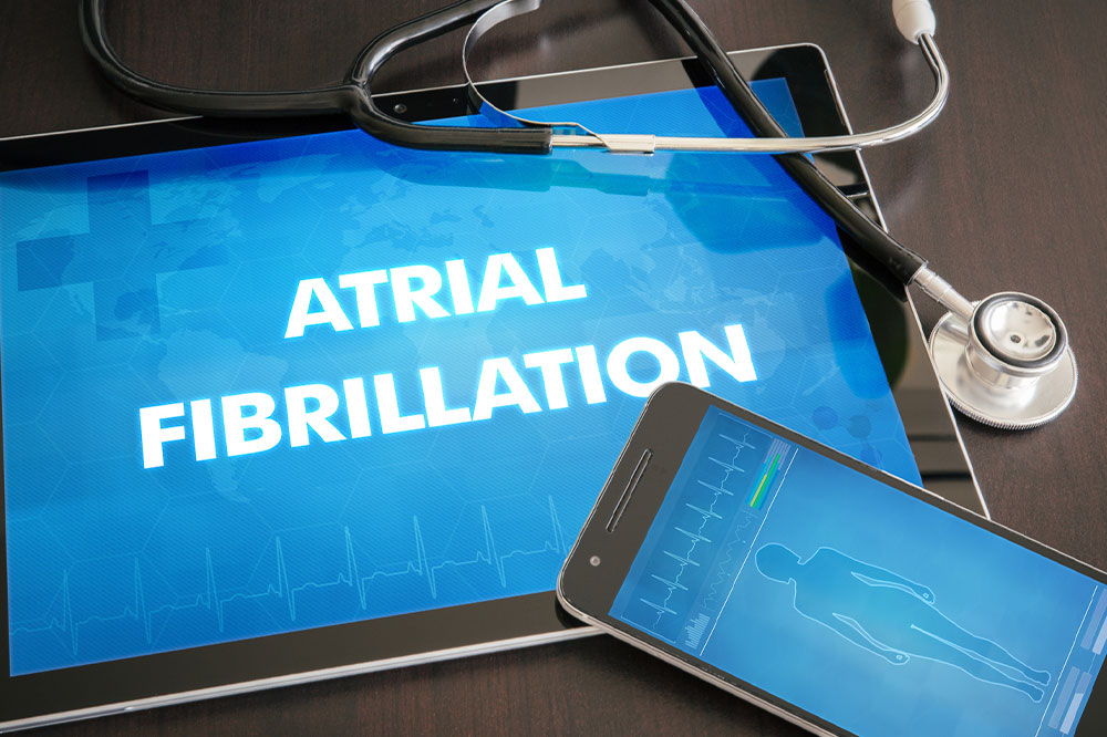 Atrial fibrillation – Causes, symptoms, and management tips
