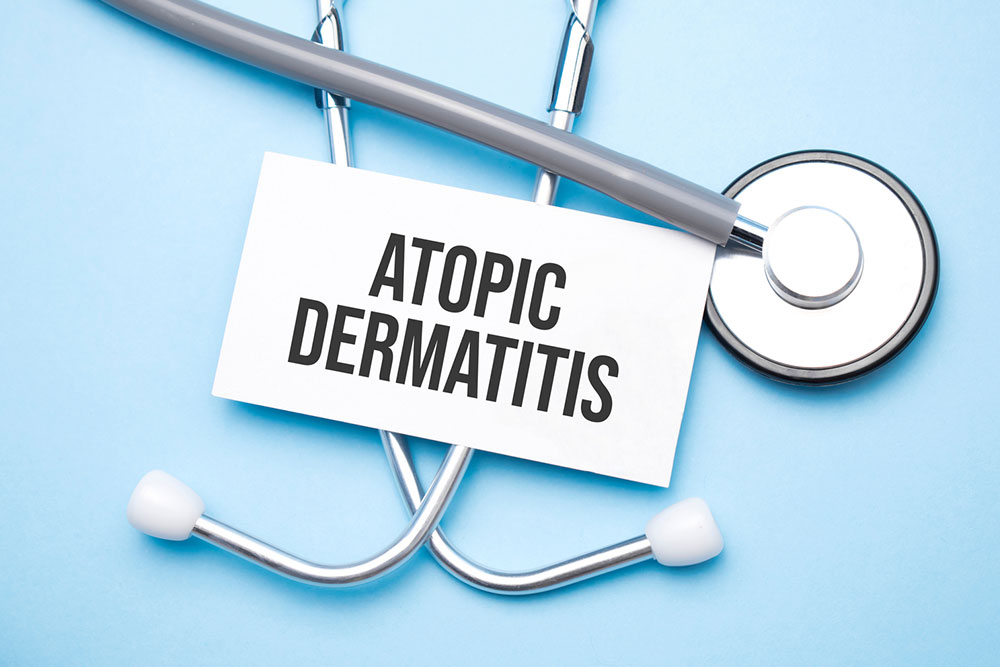 3 strategies for managing atopic dermatitis